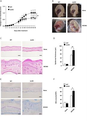 Congenital Deficiency of Conventional Dendritic Cells Promotes the Development of Atopic Dermatitis-Like Inflammation